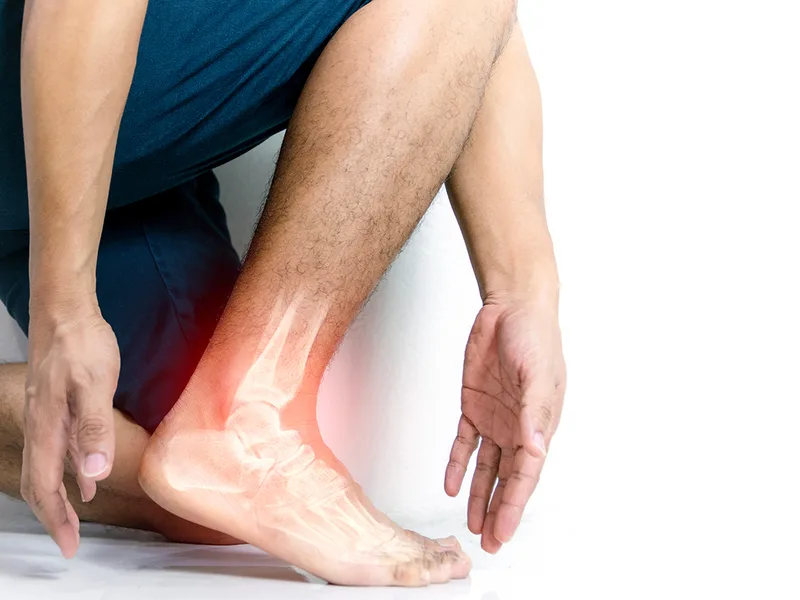 Alter Chiropractic treating leg pain in Delray Beach
